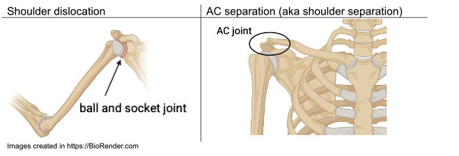 Shoulder Image